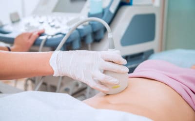 Los miomas y su implicación en la infertilidad femenina