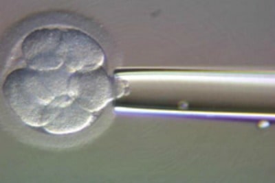 Biopsia embrionaria para DGP