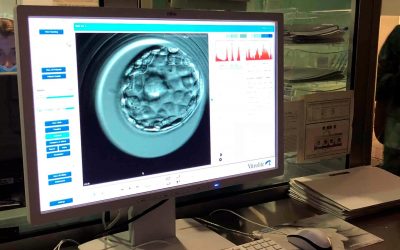 Clasificación de embriones por su calidad en un tratamiento de fecundación in vitro