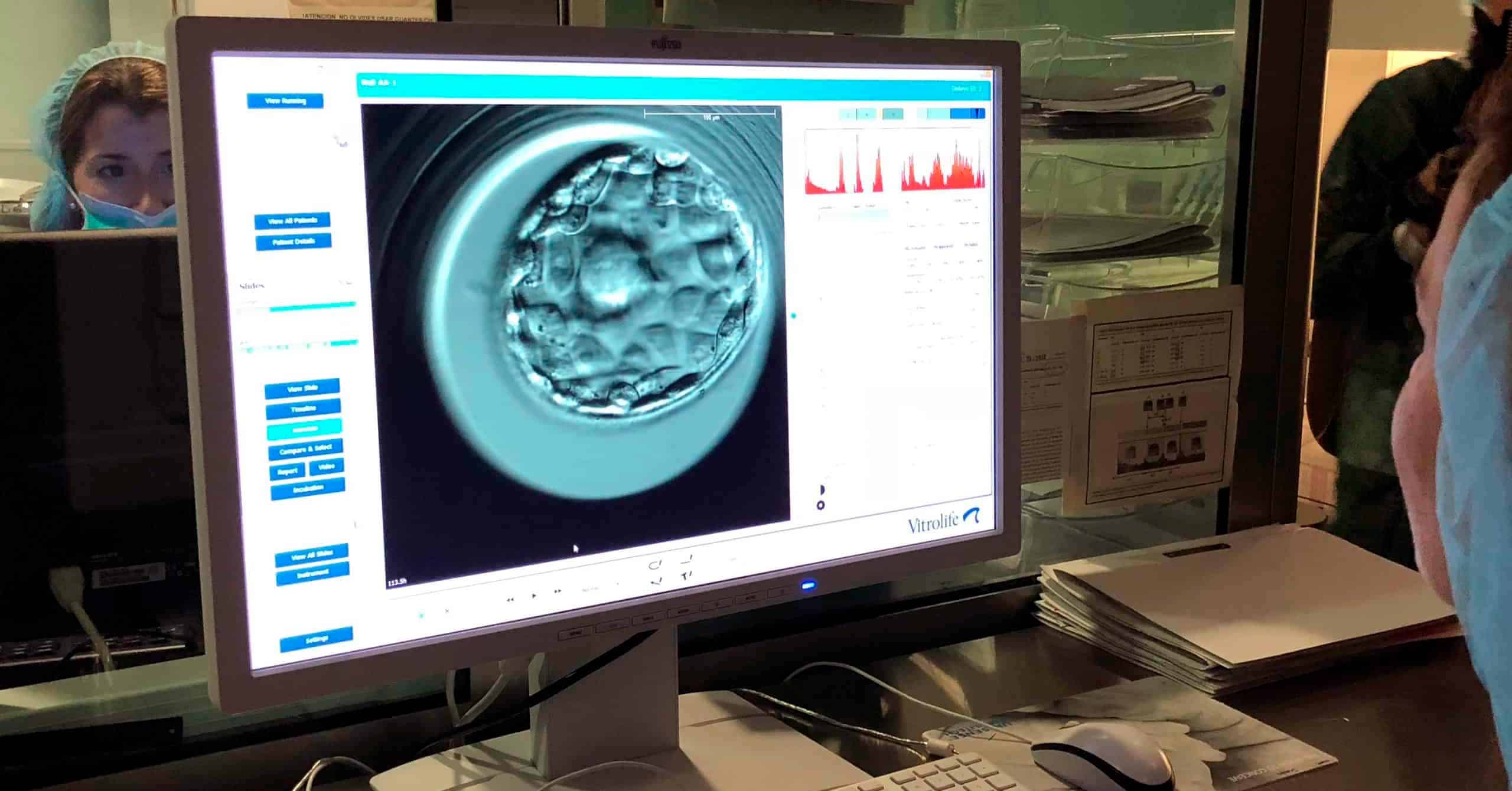 Clasificación de embriones por su calidad en un tratamiento de fecundación in vitro | URE Centro Gutenberg
